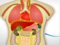 Organ Transplant 2 ஆன்லைன் விளையாட